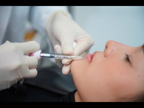 Video Hạnh Hanna Tiêm Filler Môi | Dr Hoàng Tuấn - youtube
