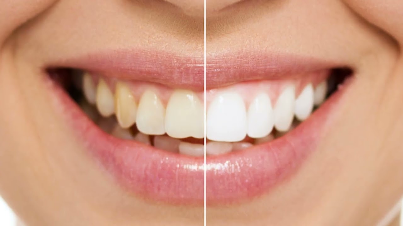 Veneto Dental Care : Dentist Office in Miramar, FL | 33025