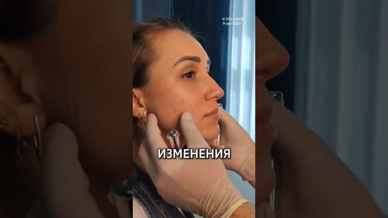 Самая проблемная зона на лице и как её корректировать?