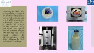 The Effect of GSE on Micro-tensile Bond Strength and Resin- dentin Bond Durability