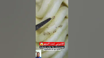 الإندومي تحت الميكرسكوب أو تحت المجهر أمراض 