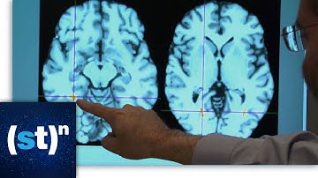 Dr. Michael Lipton discusses the risks associated with concussions