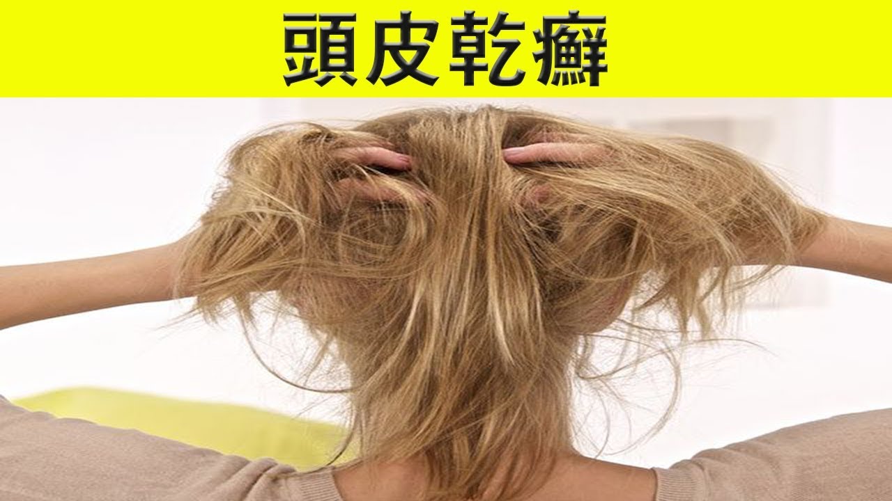 乾癬の鱗屑を適切に除去する方法