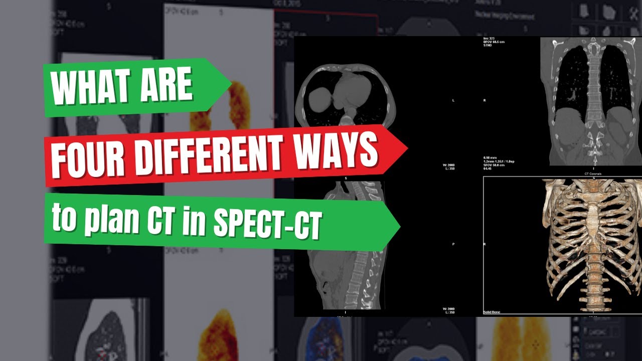 Planning CT in 4 Unique Ways | SPECT-CT on NM CT 860 - YouTube