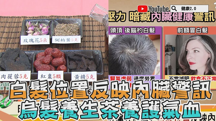 白发位置 反映内脏健康警讯！ 乌发养生茶 养护气血 健康2.0 精华 - 天天要闻