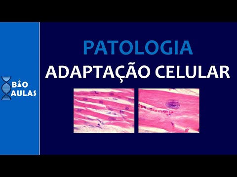 Vídeo: Como as aberrações no ciclo celular podem levar?