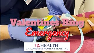 A Stuck Valentines Ring Emergency