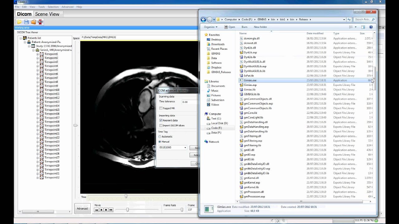 DICOM Browser in GIMIAS