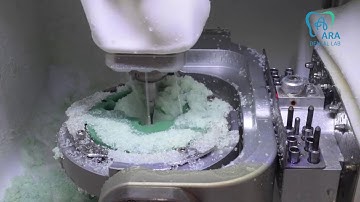 wax milling partial frame (magic of full palatal frame) Korea