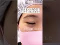 【二重整形】逆まつげ必見！パッチリ二重な出来ます　#shorts