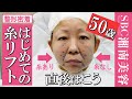 【50歳糸リフト密着】初整形アラフィフのタルミ上げ♥糸選びからオペ直後までを追ったら上がってた【タルミ・ほうれい線・フェイスラインを引き上げて小顔】＠湘南美容クリニック