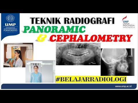 BELAJAR RADIOLOGI #10 - PANORAMIC DAN CEPHALOMETRY #radiologi #radiografer