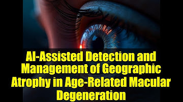 AI-Assisted Detection and Management of Geographic Atrophy in Age-Related Macular Degeneration