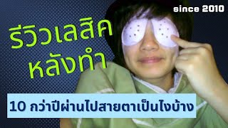 ทำเลสิคมา 10 ปีกว่า ตอนนี้เป็นยังไงบ้าง พร้อมเล่าประสบการณ์