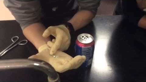 Liquid Metal Embrittlement