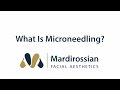 What is Microneedling?