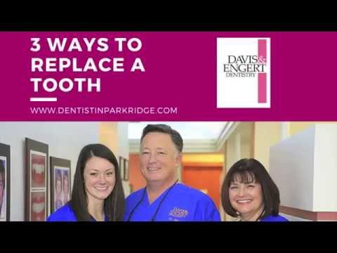Dentist in Park Ridge Discusses 3 Ways to Replace Missing Teeth