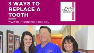 Dentist In Park Ridge Discusses 3 Ways To Replace Missing Teeth
