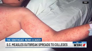 South Carolina measles outbreak spreads to colleges
