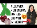 Onion and Aloe Vera for Hair || Get Long Strong and Healthy Hair In 1 Month
