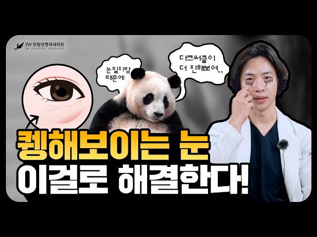눈밑지방재배치, OO 제대로 조절 못하면 재발한다고? 😅😅 눈성형 전문 김연준원장이 눈밑지 핵심 알려드림!!