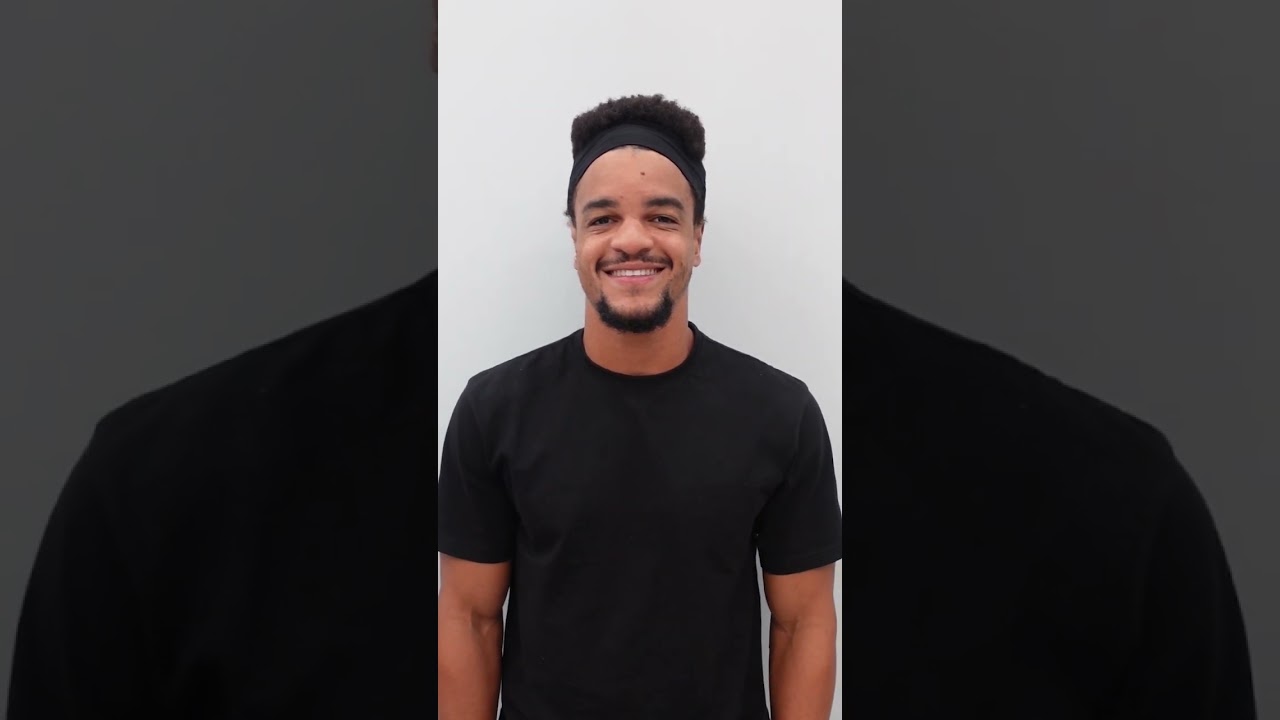 Otoplasty Surgery Before After #otoplastia