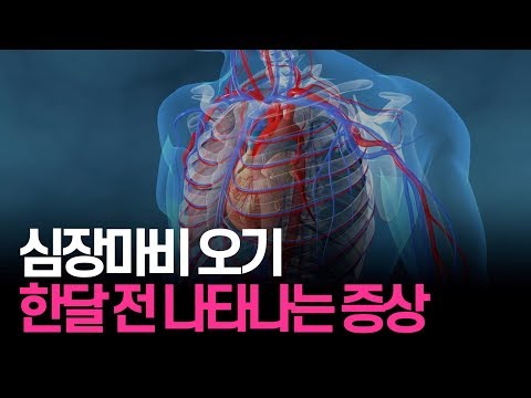 심장마비 오기 한달 전 나타나는 증상