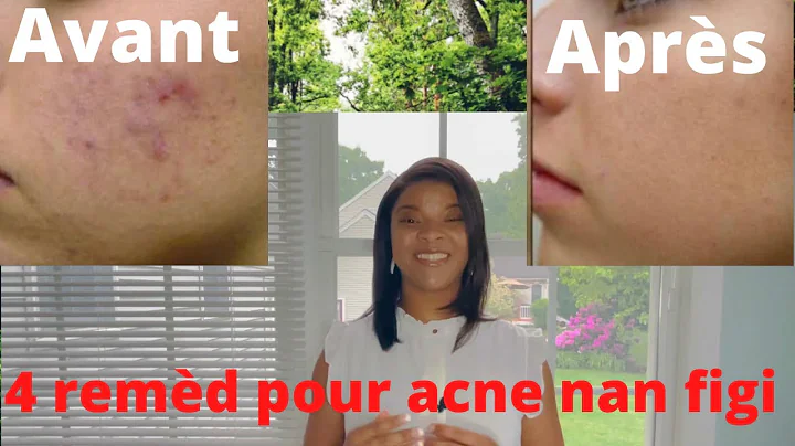 4 facial tout fanm dwe konnin.4 rest pou paret plu...