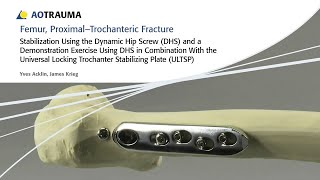 Femur, Proximal – Trochanteric Fractures – Stabilization Using the Dynamic Hip Screw DHS with ULTSP