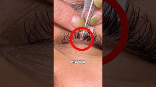 Ingrown Lash Removal 😳