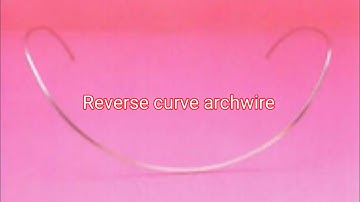 TTT of open bite video 3 : reverse curve wire