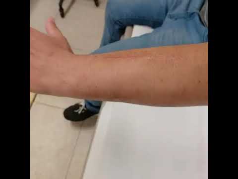 Testimonio | Dr. Miguel Angel Romo Manriquez