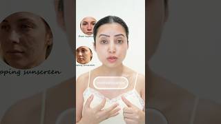 Exfoliate #pigmentation #darkspots #unevenskin #skincare #brightskin #skincareroutine #shorts