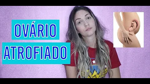 Quais os sintomas de Ovario atrofiado?