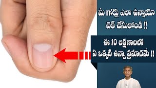 How Nails Warns about Your Health | Nail Diseases | Lack of Blood | Dr. Manthena