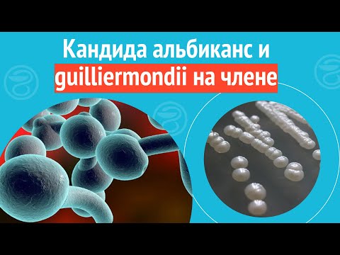 😕 Кандида альбиканс и guilliermondii на члене. Клинический случай №1118