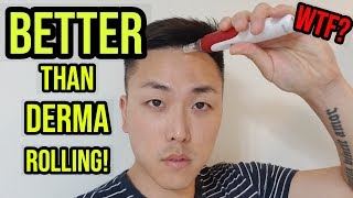 This Is Better Than Derma Rolling For Hair Growth