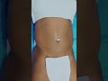 LIPO HD EM FALSA MAGRA: Como destacar os músculos escondidos? 🔥
