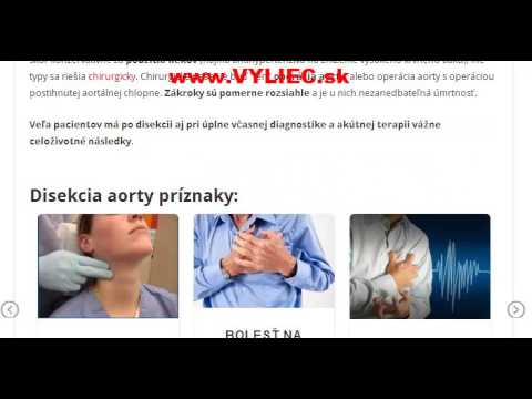 Video: Disekcia Aorty - Príčiny, Typy A Príznaky Disekcie Aorty, Liečba