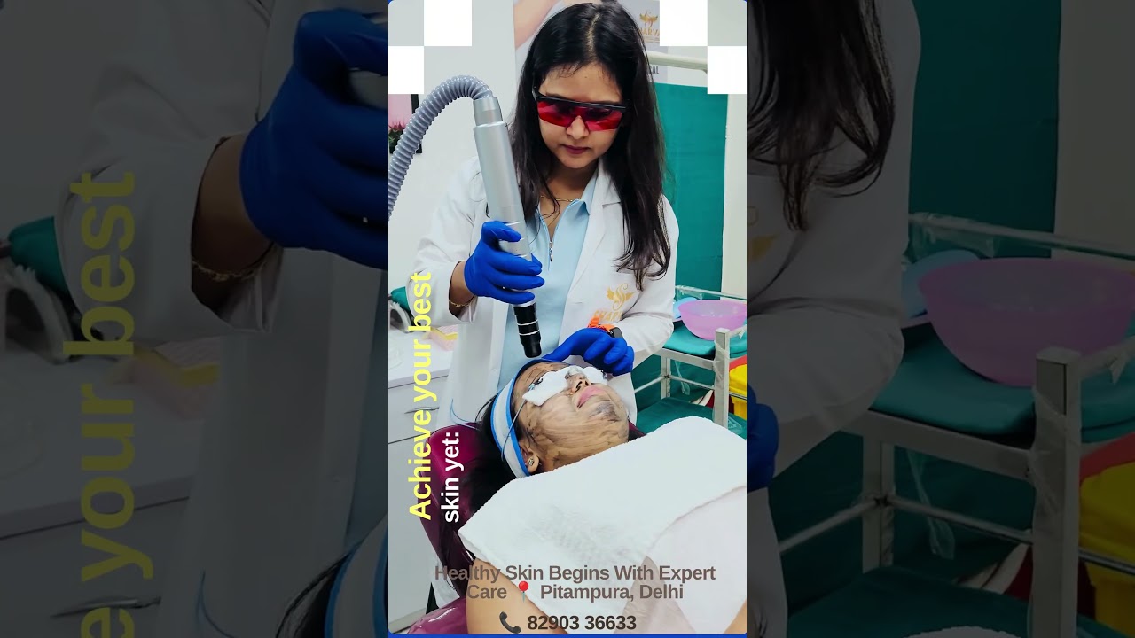 Carbon Peel Laser for Glowing Skin | Laser Facial Treatment in Pitampura, Delhi | Sharva Clinic