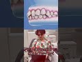 【海外治療動画を見る】マウスピース矯正 #歯科医 #歯科医師 #歯科治療