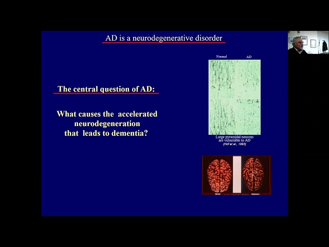 Clinical Trials, FAD Variants, and the Etiology of Alzheimer’s Disease