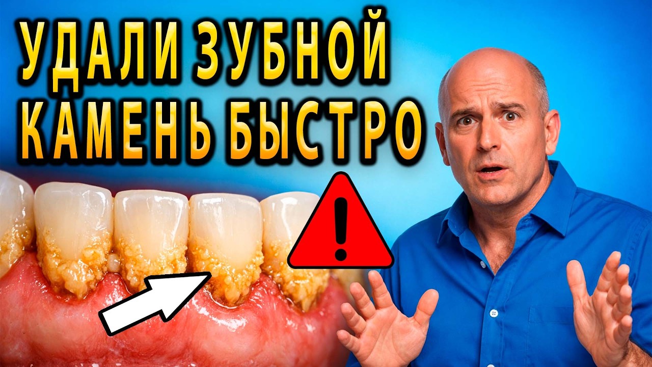 ЗУБНОЙ КАМЕНЬ ИСЧЕЗНЕТ? 😱 Как Удалить Налёт ДО Стоматолога!