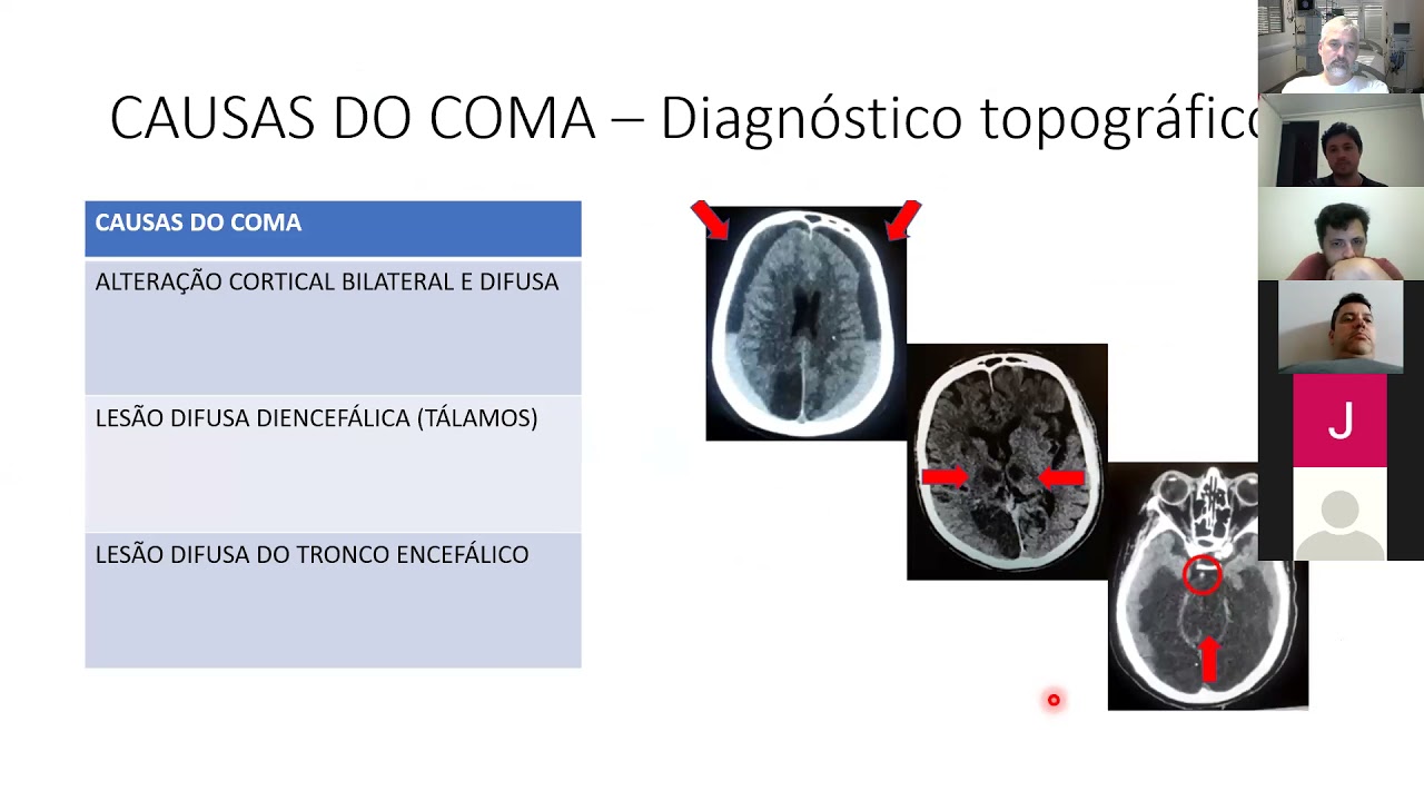 Exame Neurológico no Paciente Crítico