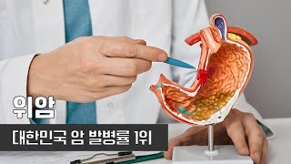 대한민국 암 발생 1위라는 불명예, 위암 I 특별한 증상없이 찾아오는 위암 I 건양대학교 외과 교수 이상억 I 건강플러스