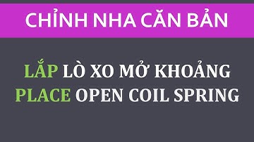 Lắp lò xo mở khoảng xử lý chen chúc Insert Open Coil Spring
