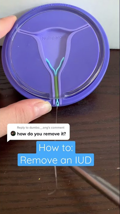 Ever wonder how we remove an IUD? Here you go! #iud #shorts #birthcontrol #obgyn