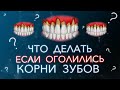 Оголились корни зубов. Что с этим делать.