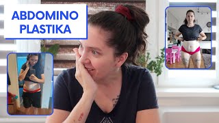 Abdominoplastika - můj příběh