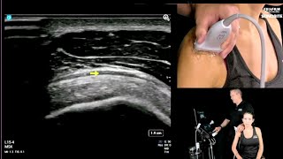 Webinar: Diagnostic Shoulder Exams - Lateral Shoulder screenshot 5